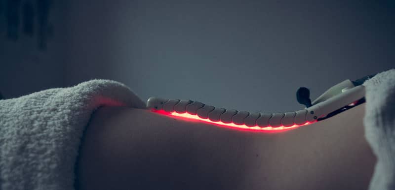 Cold laser therapy