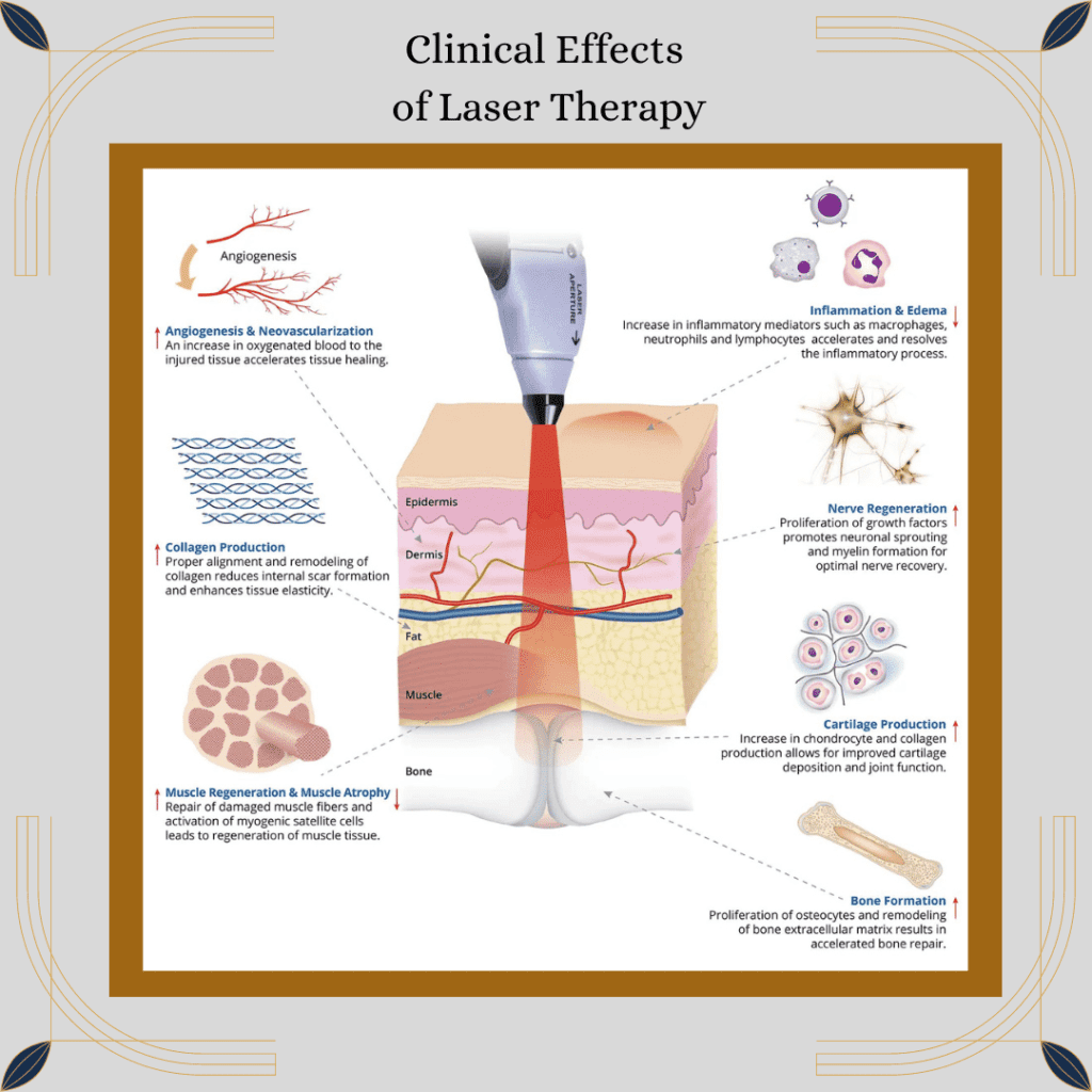 Cold Laser Therapy: A Treatment for Golfer's & Tennis Elbow 3 Laser Clinical Effects 1 1