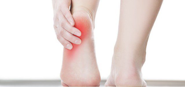 Cold Laser Therapy for Plantar Fasciitis 2 Plantar Fasciitis