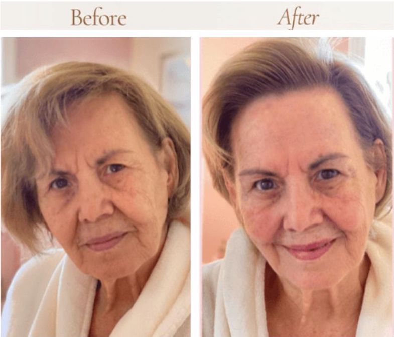 Facial Massage Therapy Before After Sfl