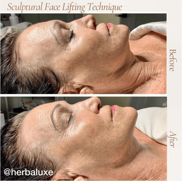 Sfl Technique | Back in Balance | Back in Balance Sfl Technique