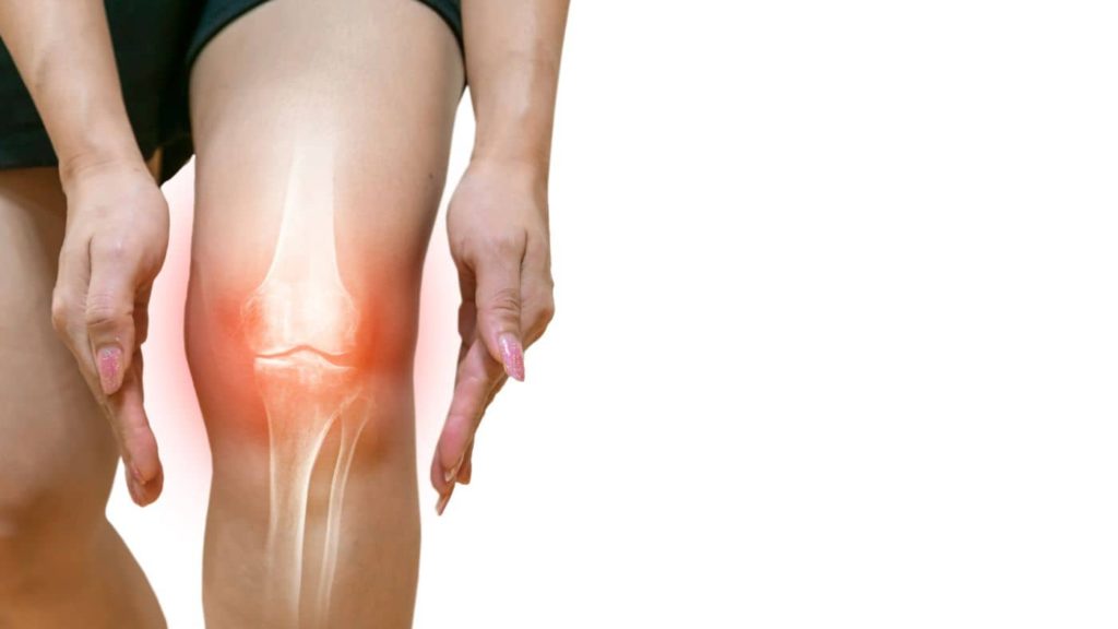 Image of a person with osteoarthritis, showing the pain and stiffness in the affected joints